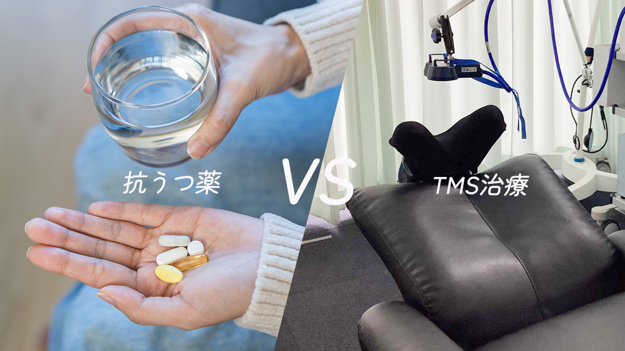抗うつ薬vsTMS治療
